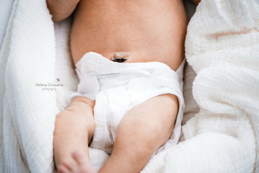 close up of baby's belly and umbilical stump during newborn photos 